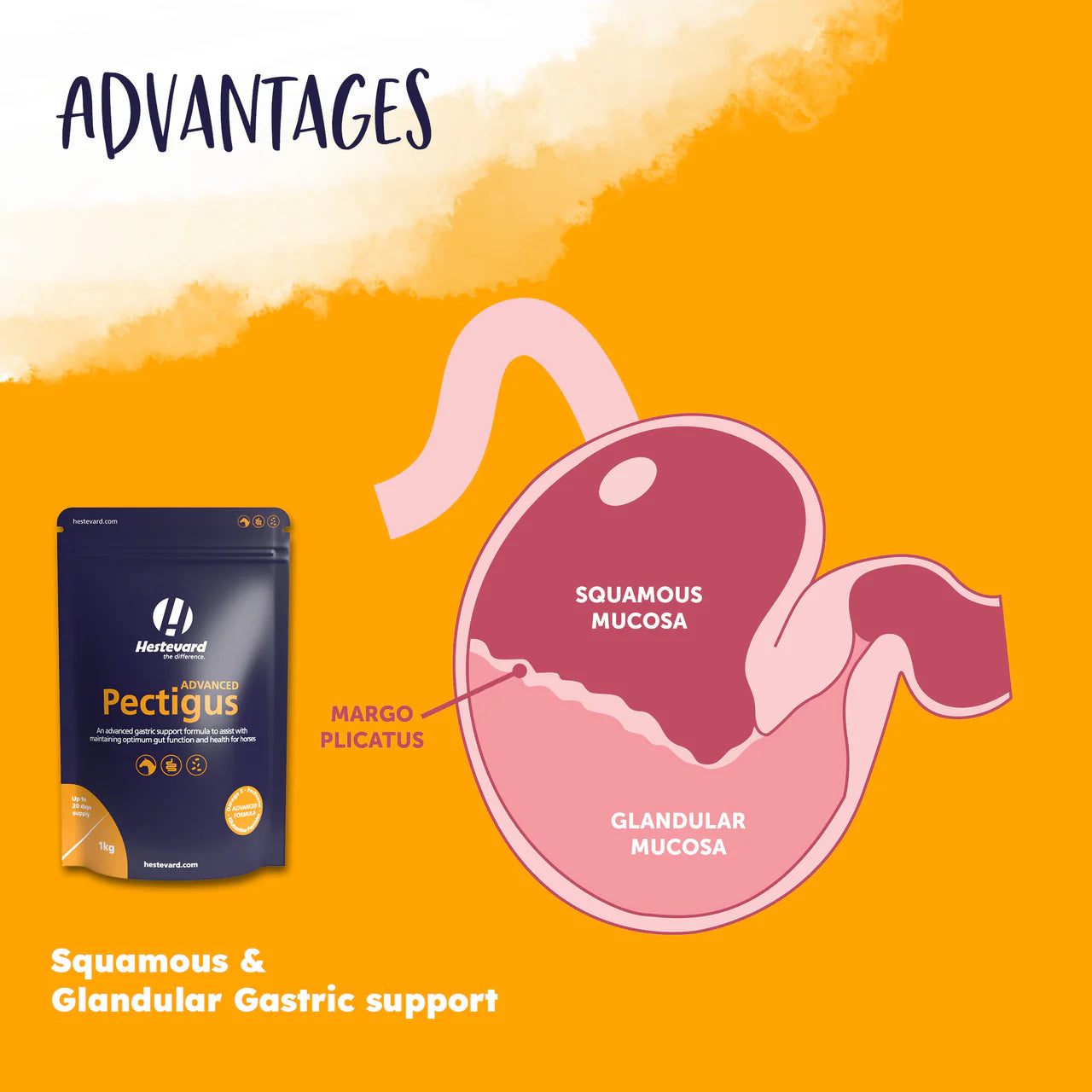 PECTIGUS ADVANCED